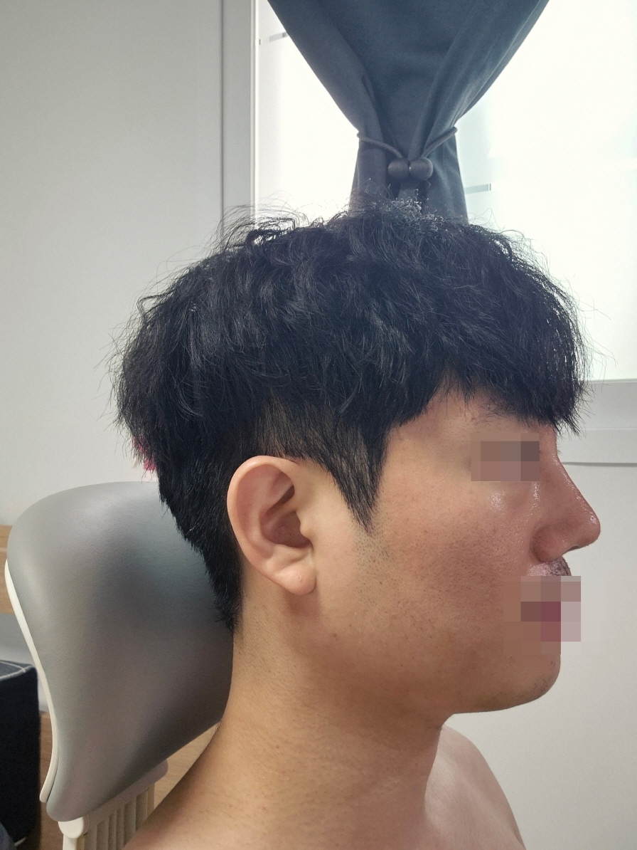 수술후기이미지