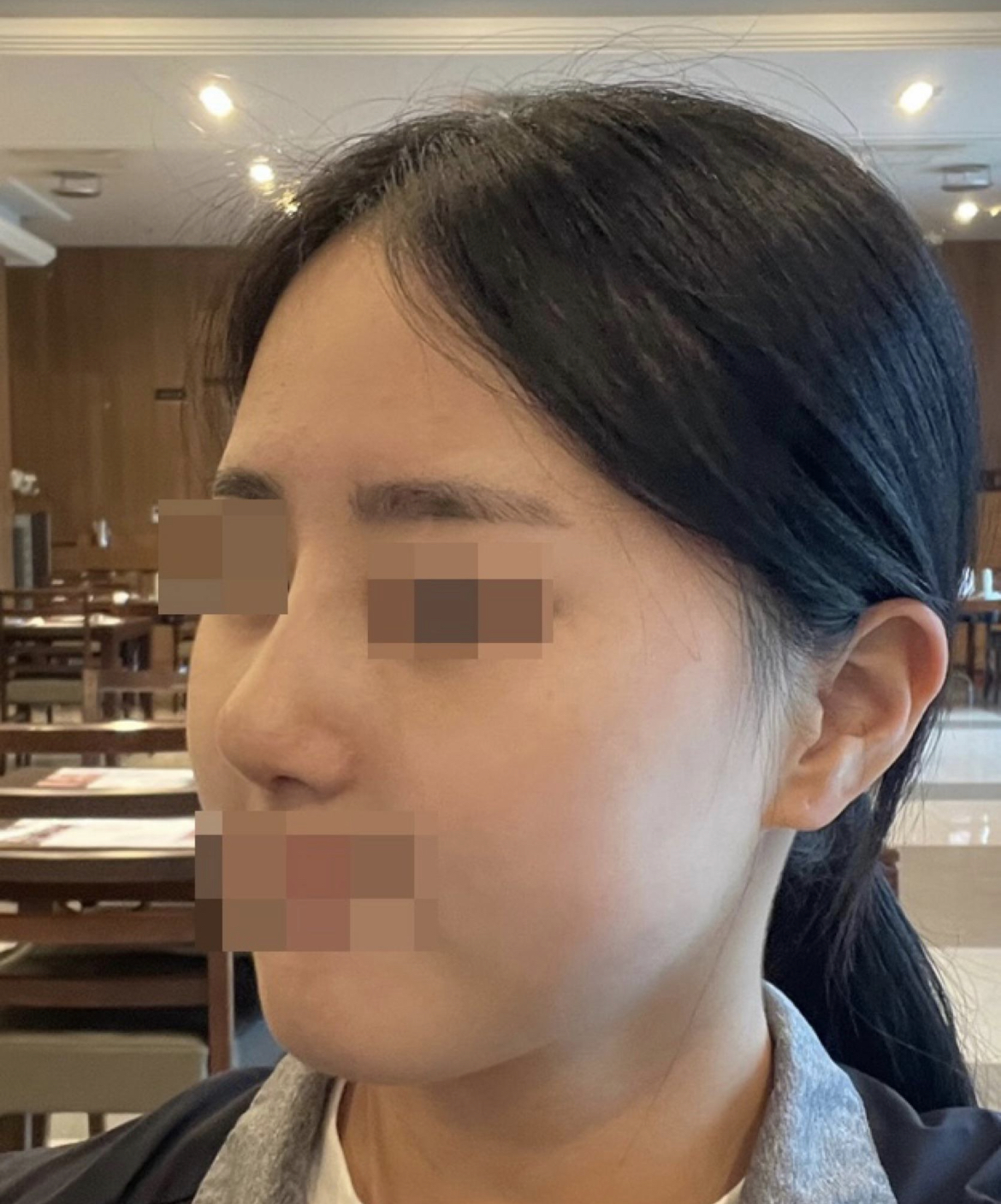 수술후기이미지