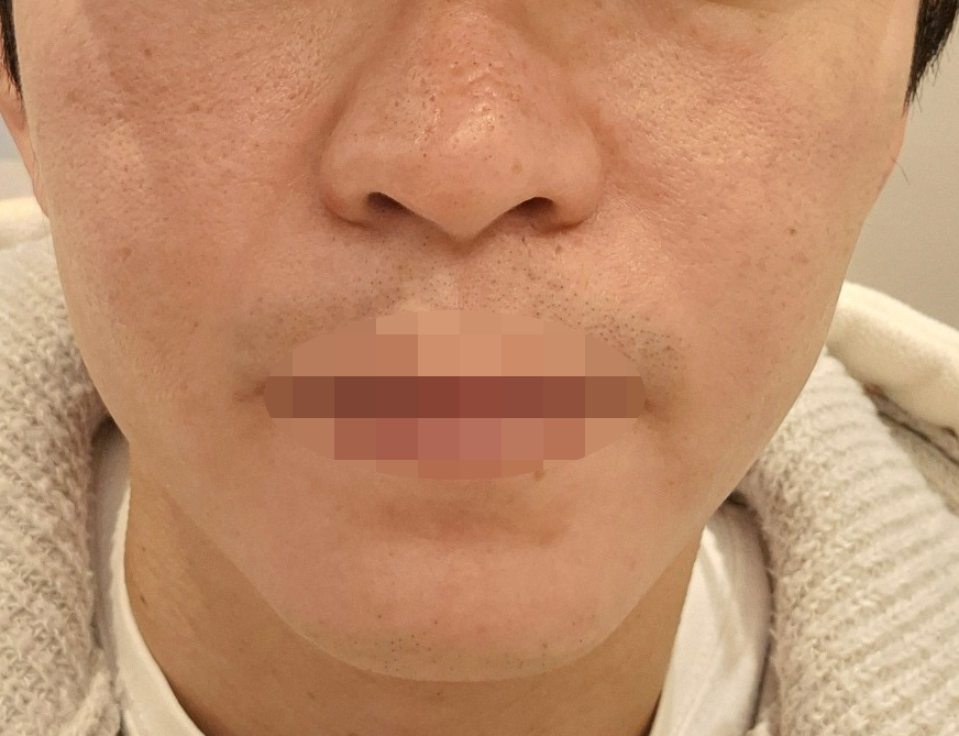 수술후기이미지