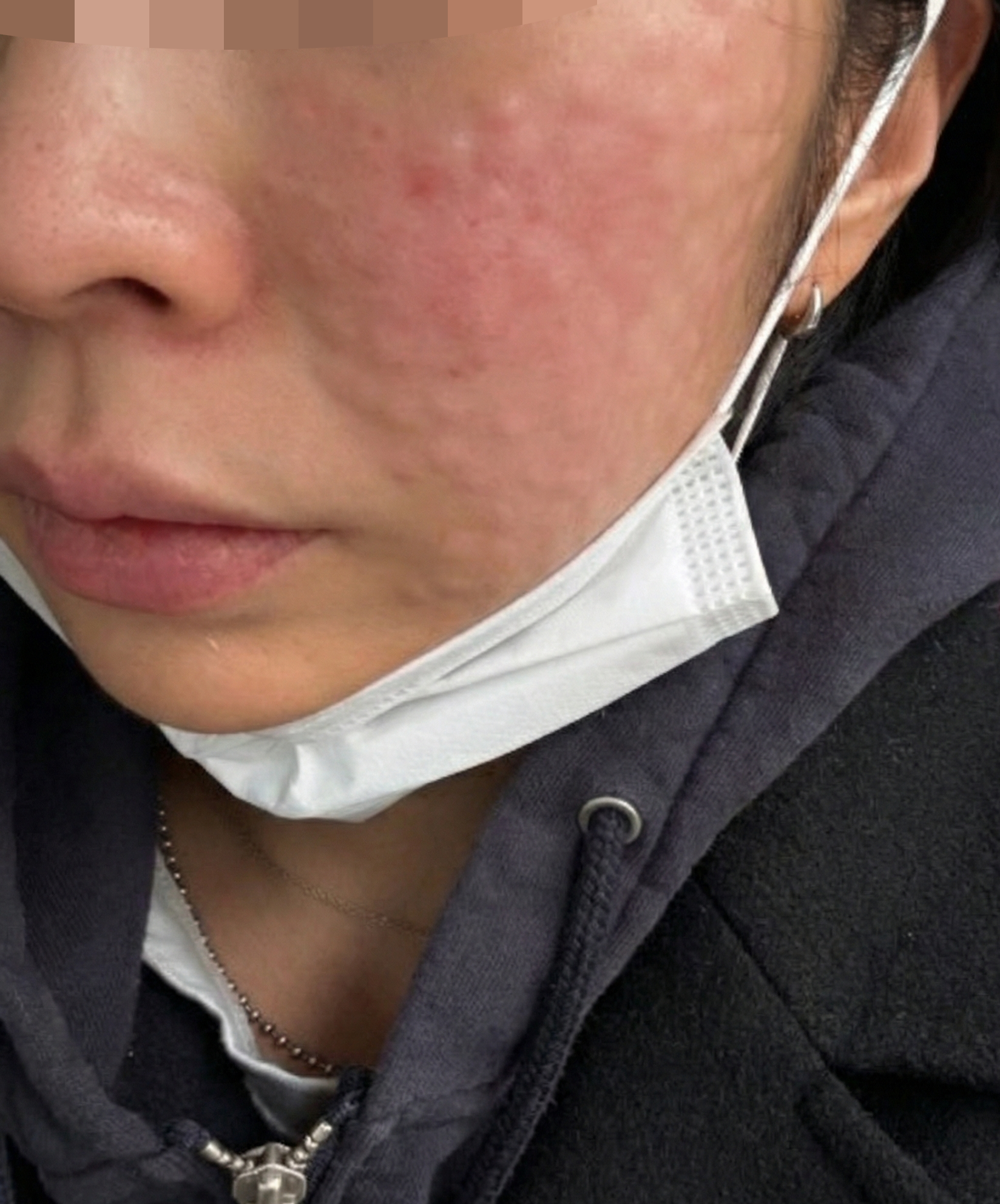 수술후기이미지