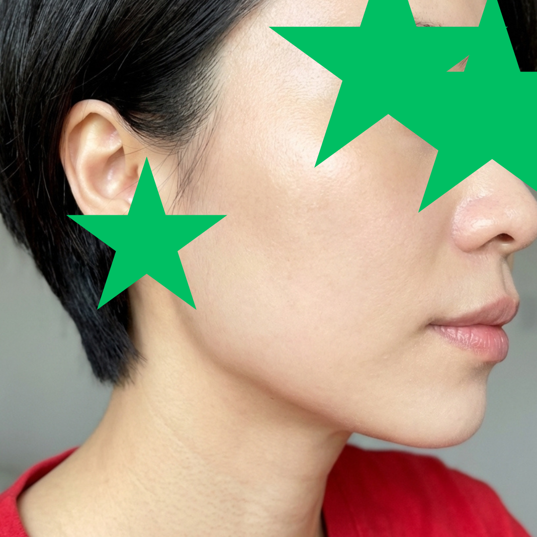 수술후기이미지