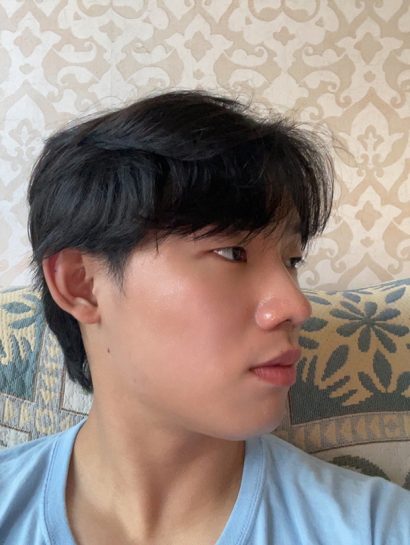 수술후기이미지