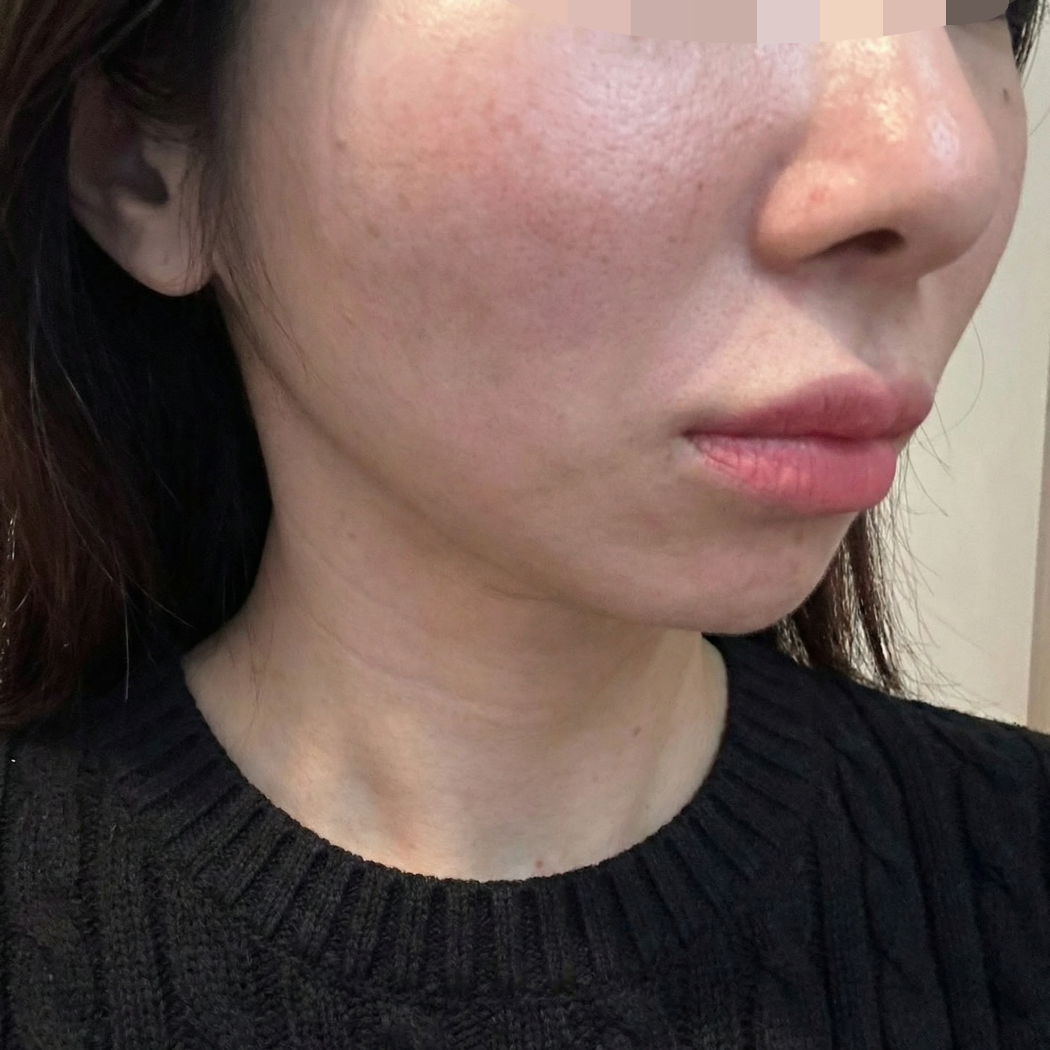 수술후기이미지