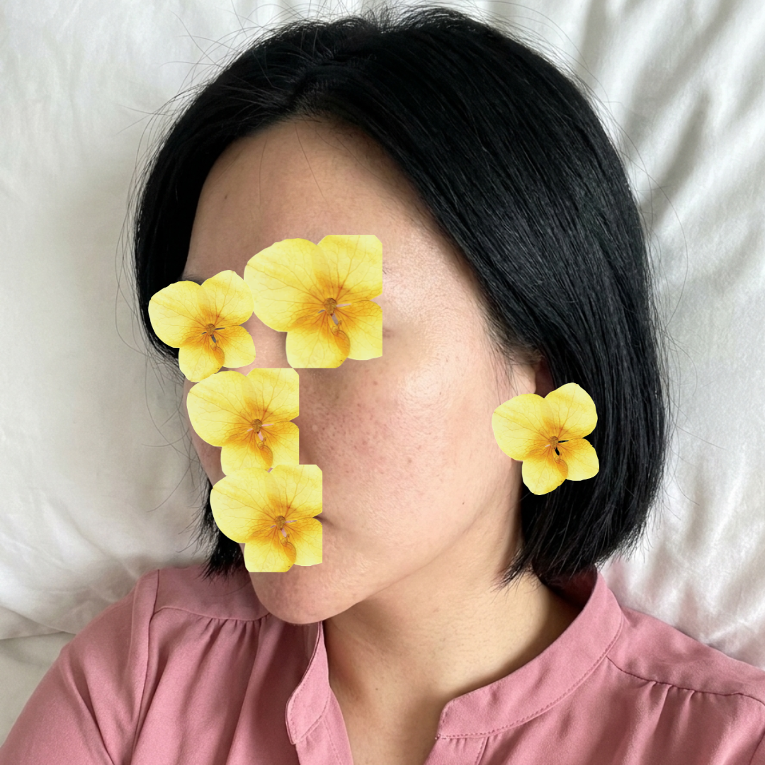 수술후기이미지