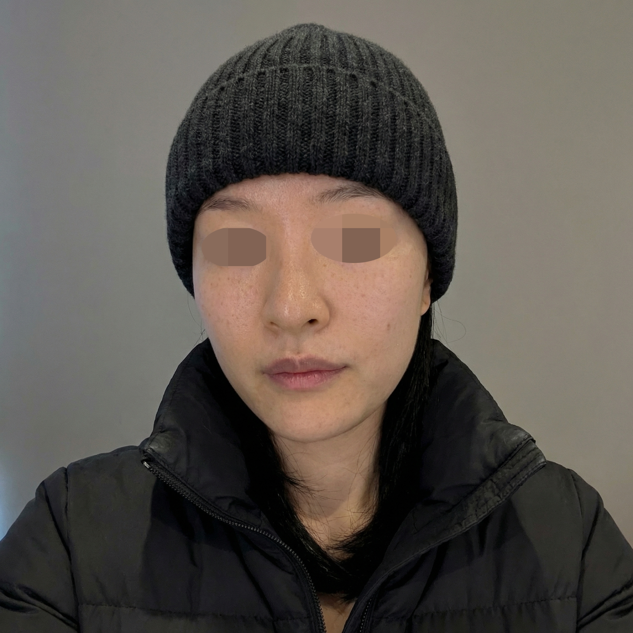 수술후기이미지