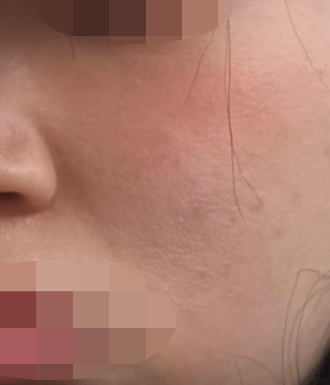 수술후기이미지