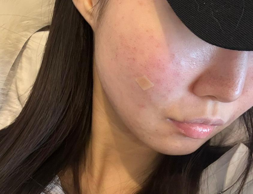 수술후기이미지