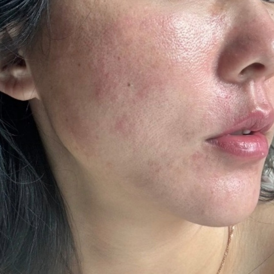 수술후기이미지