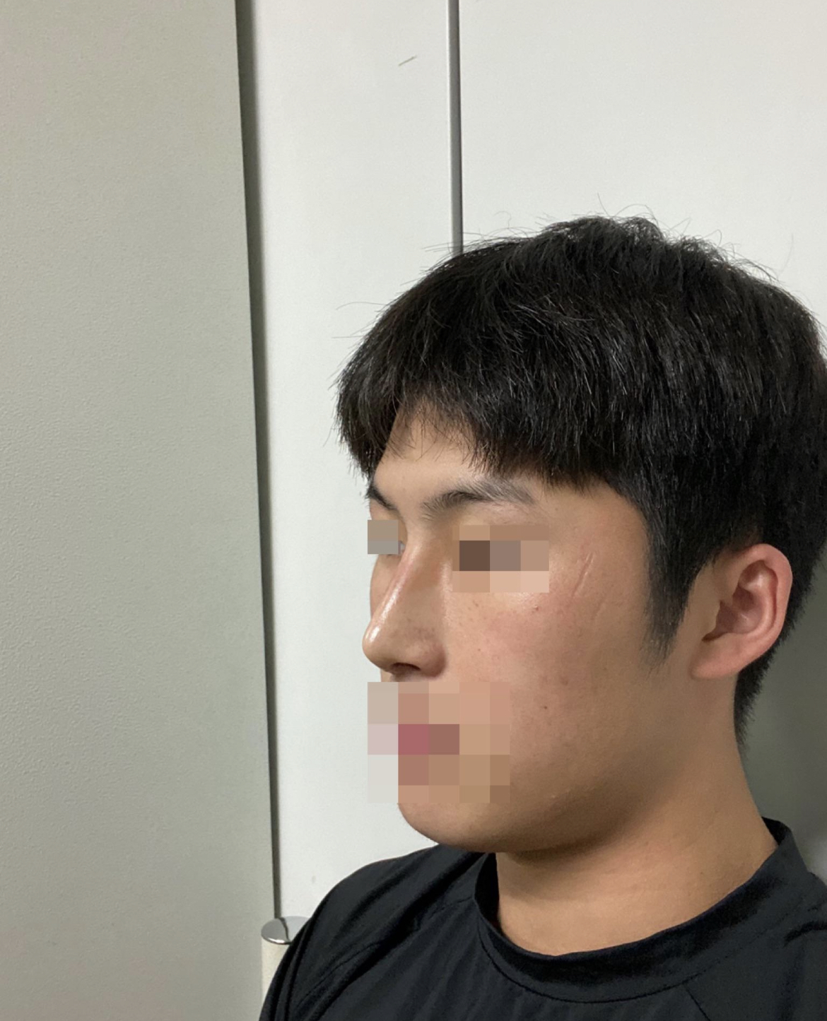 수술후기이미지