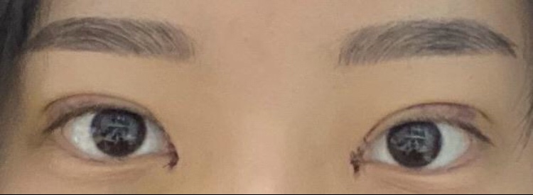 수술후기이미지