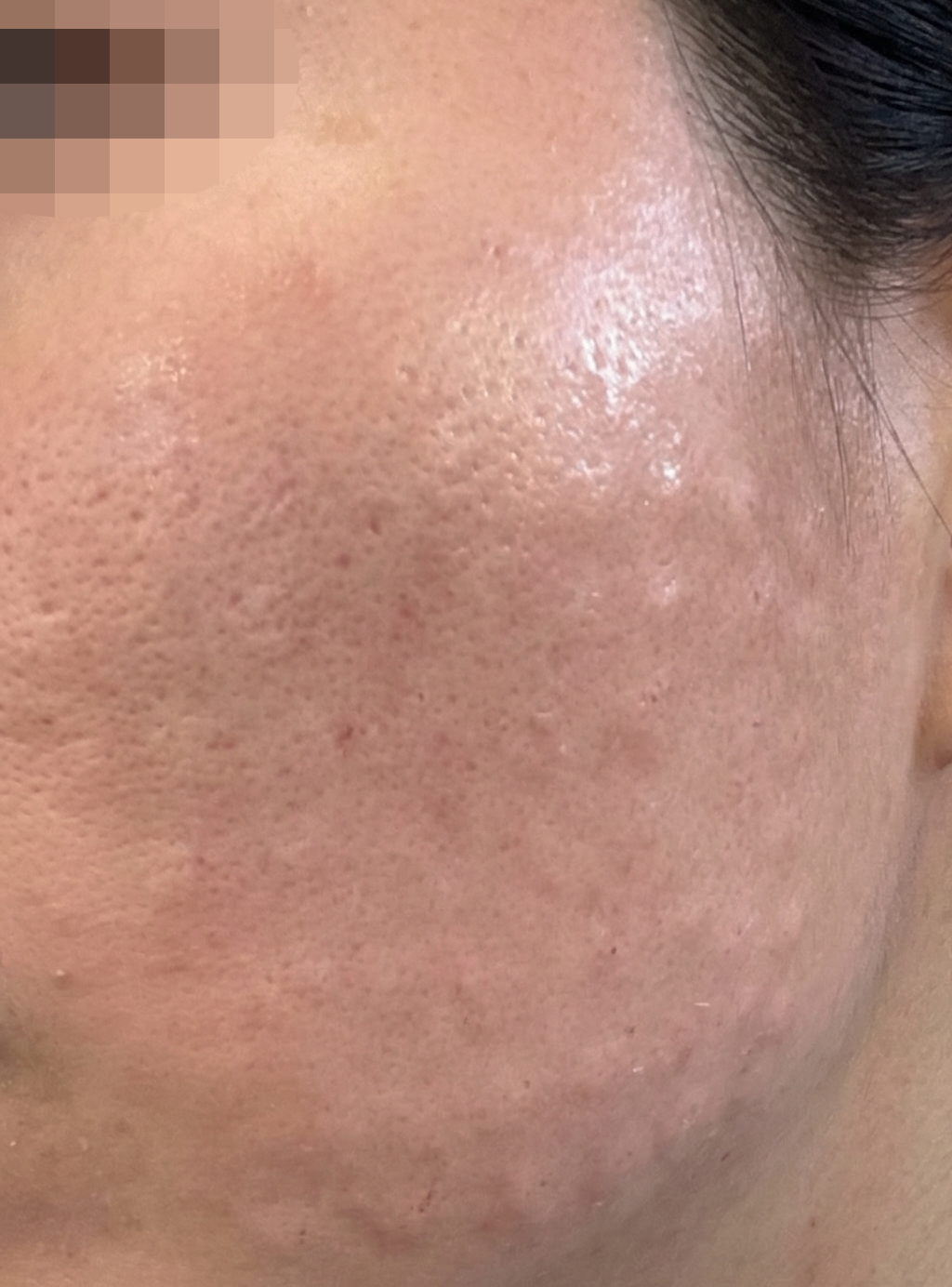 수술후기이미지