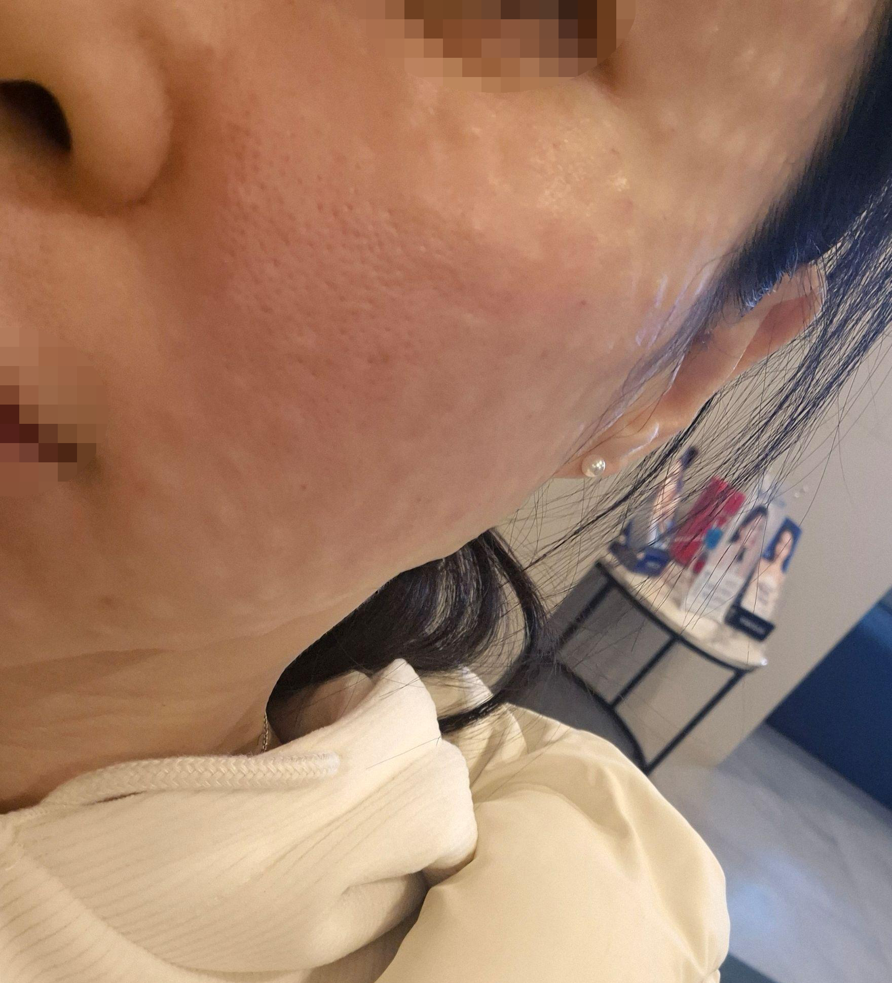 수술후기이미지