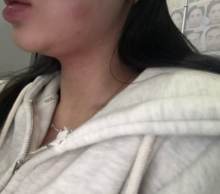 수술후기이미지