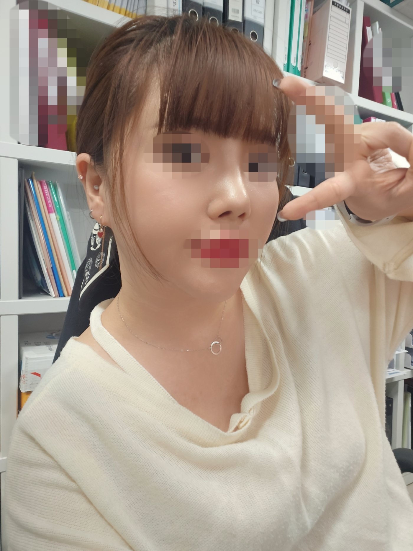 수술후기이미지