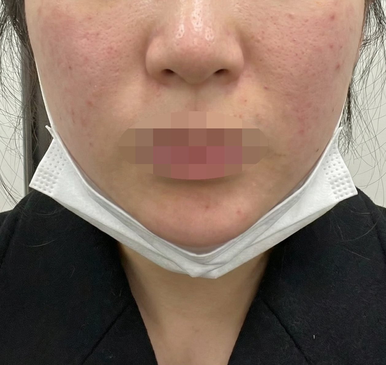 수술후기이미지