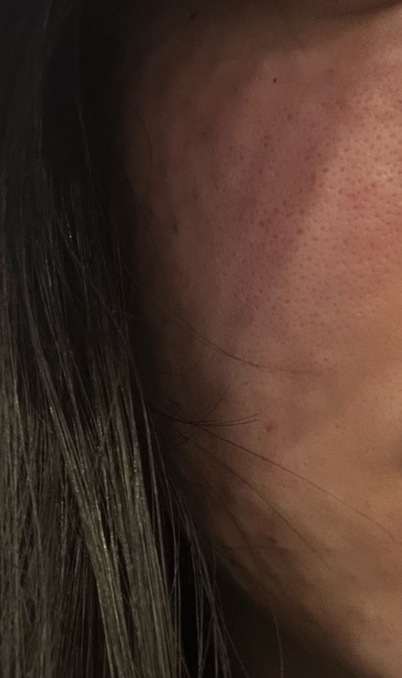 수술후기이미지