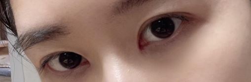 수술후기이미지