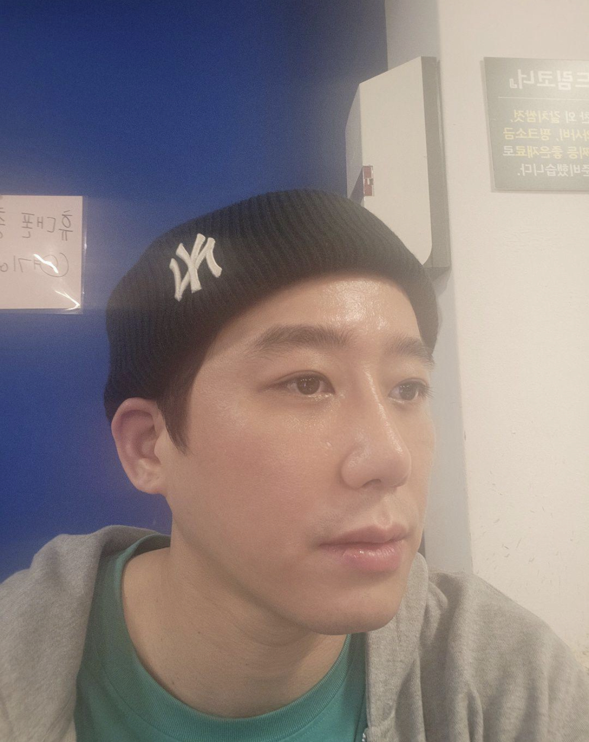 수술후기이미지