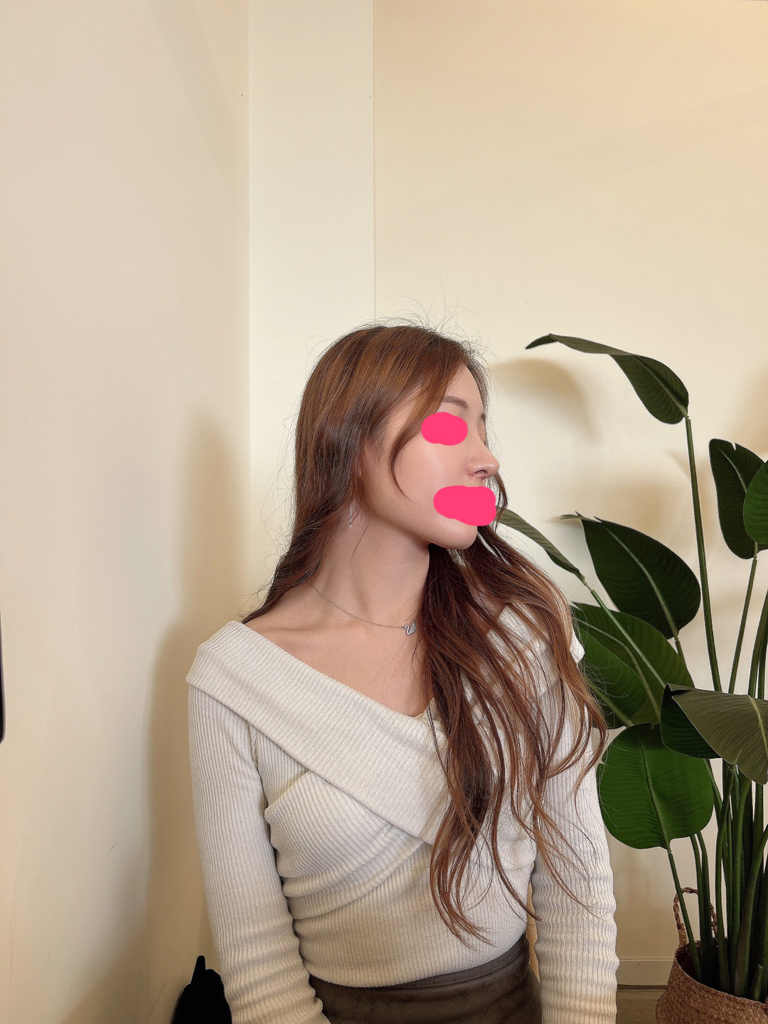 수술후기이미지