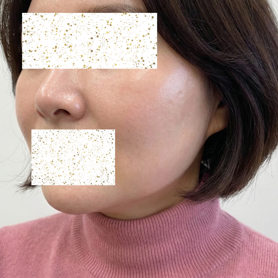 수술후기이미지