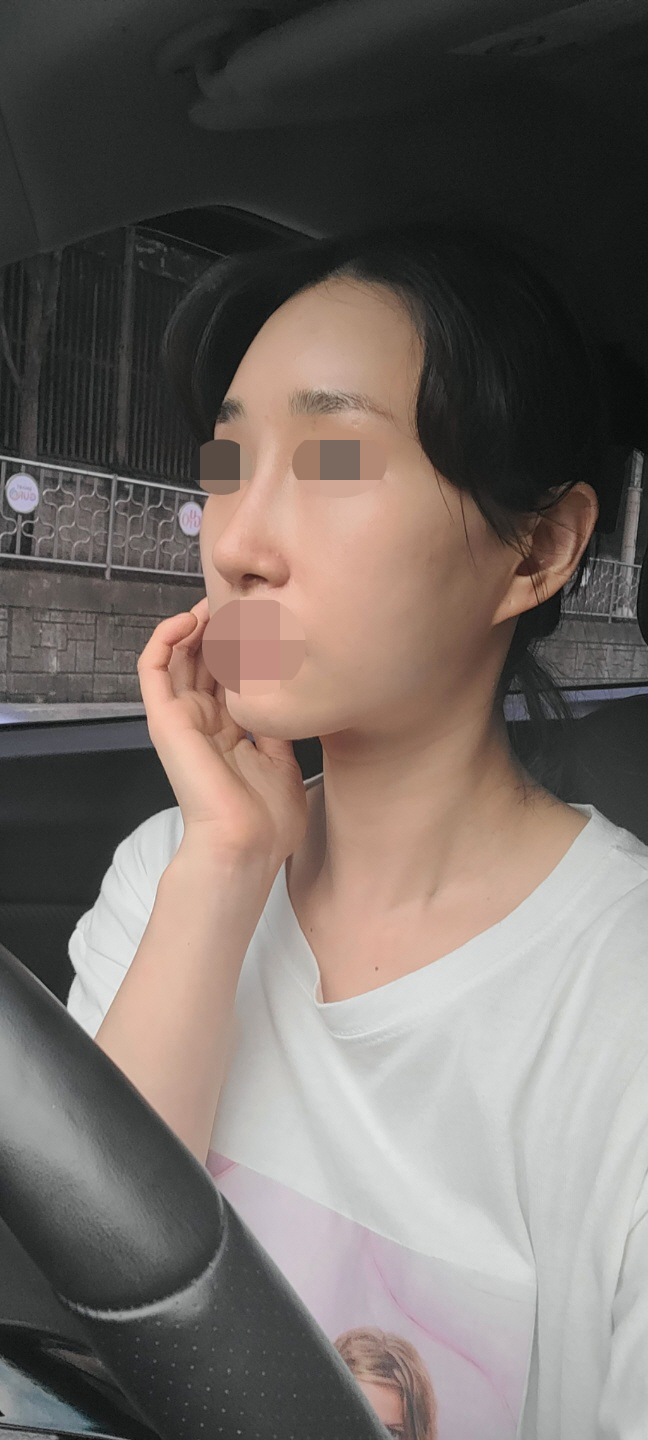 수술후기이미지