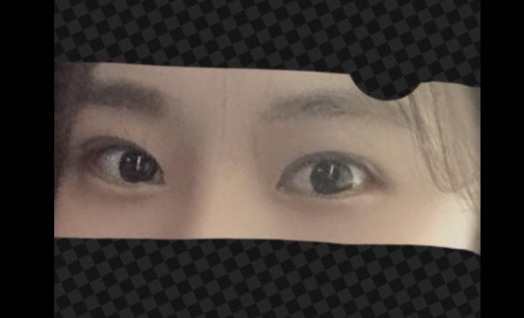 수술후기이미지