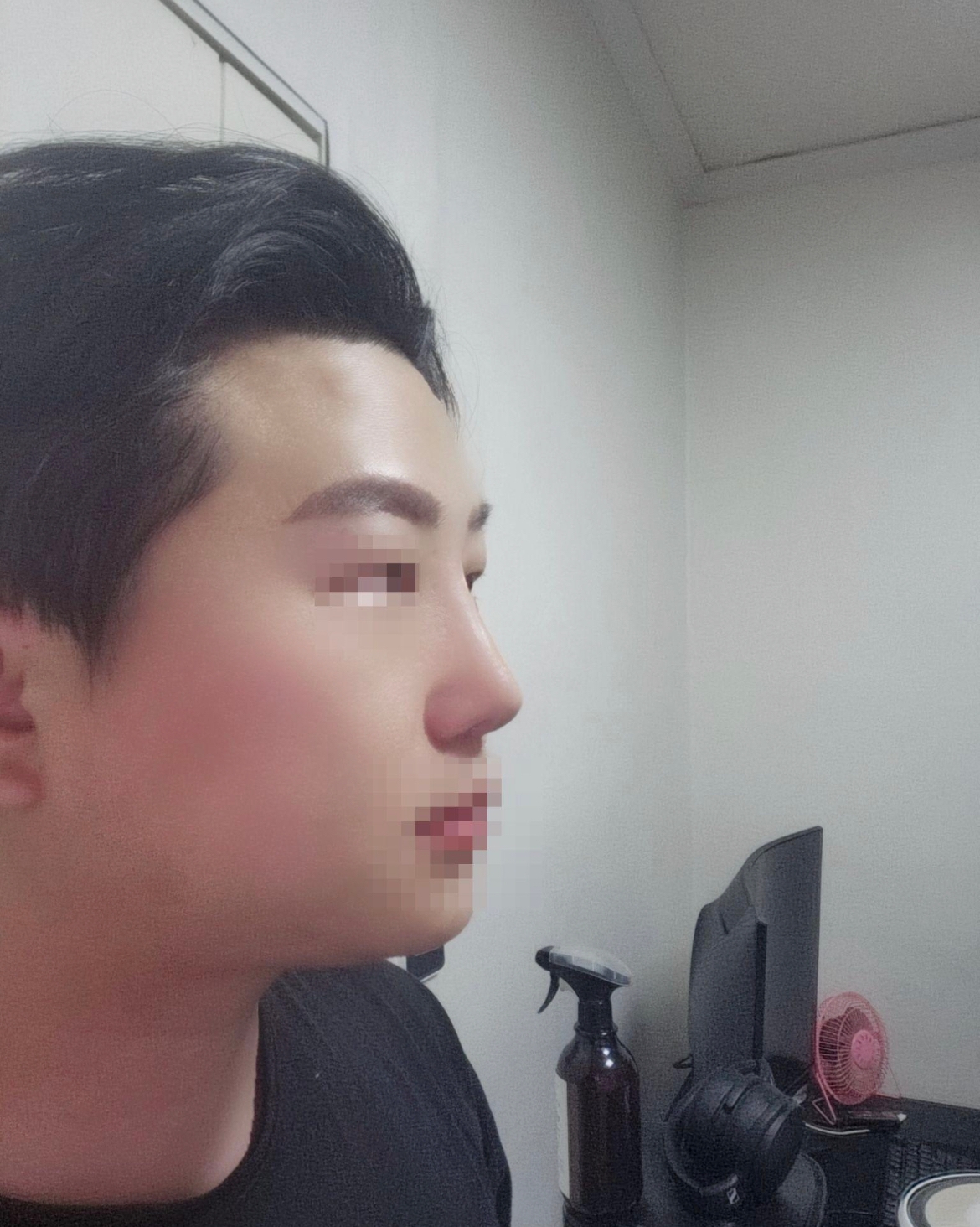 수술후기이미지