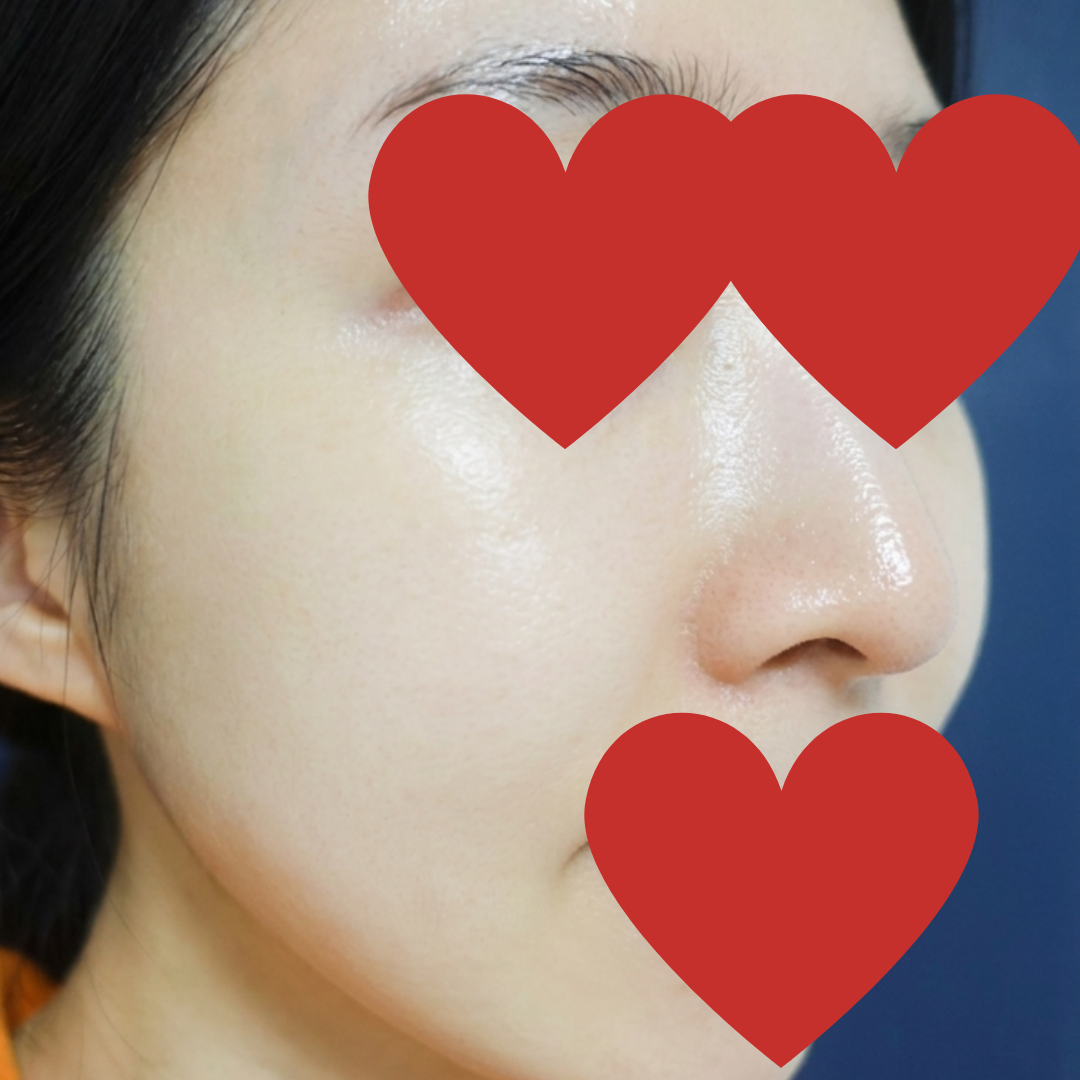수술후기이미지