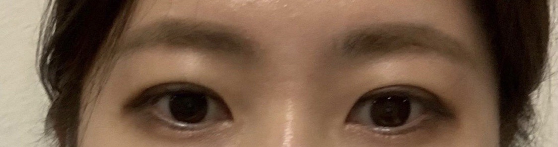 수술후기이미지