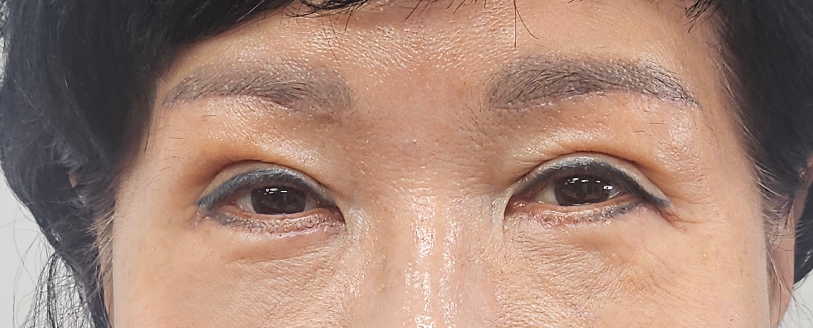 수술후기이미지