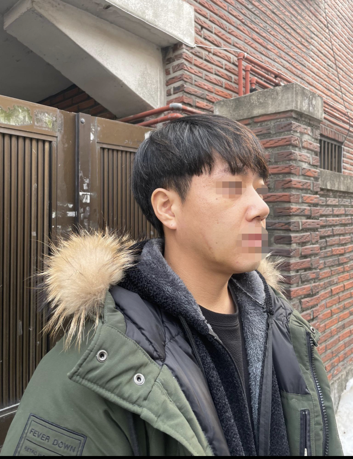 수술후기이미지