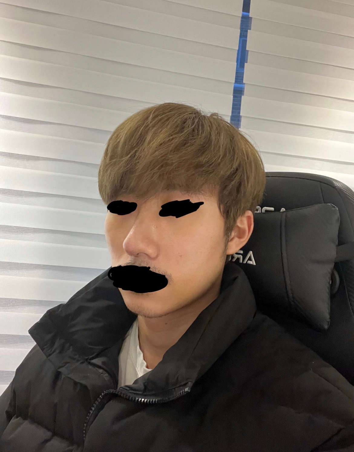 수술후기이미지