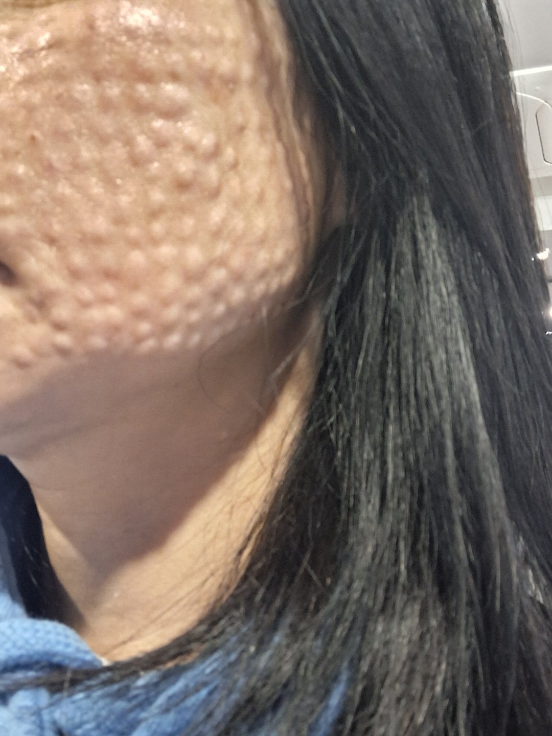 수술후기이미지