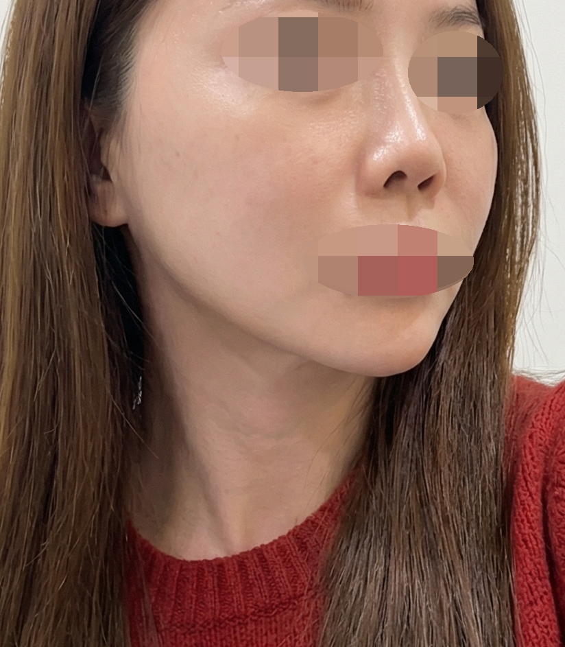 수술후기이미지