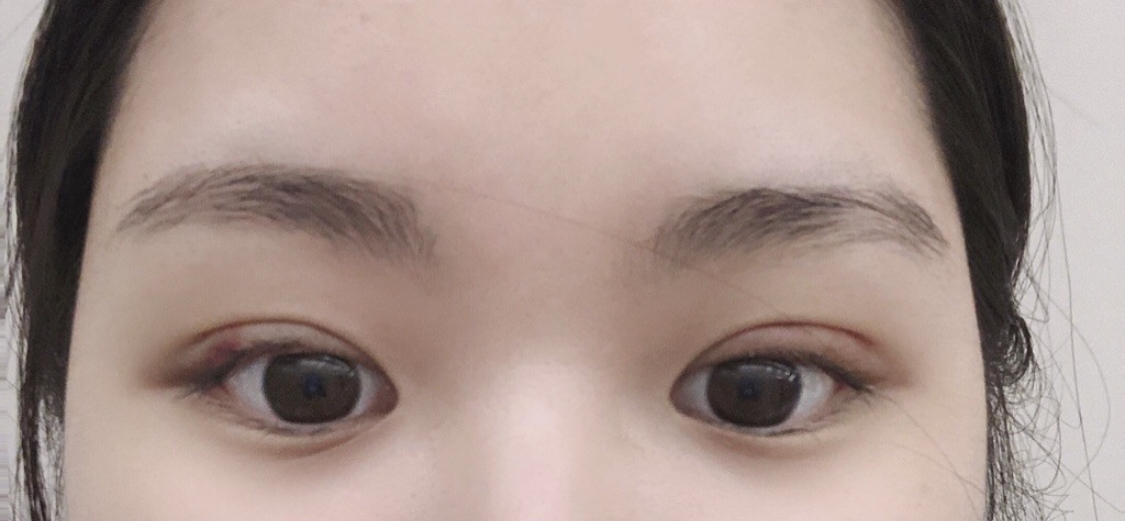 수술후기이미지