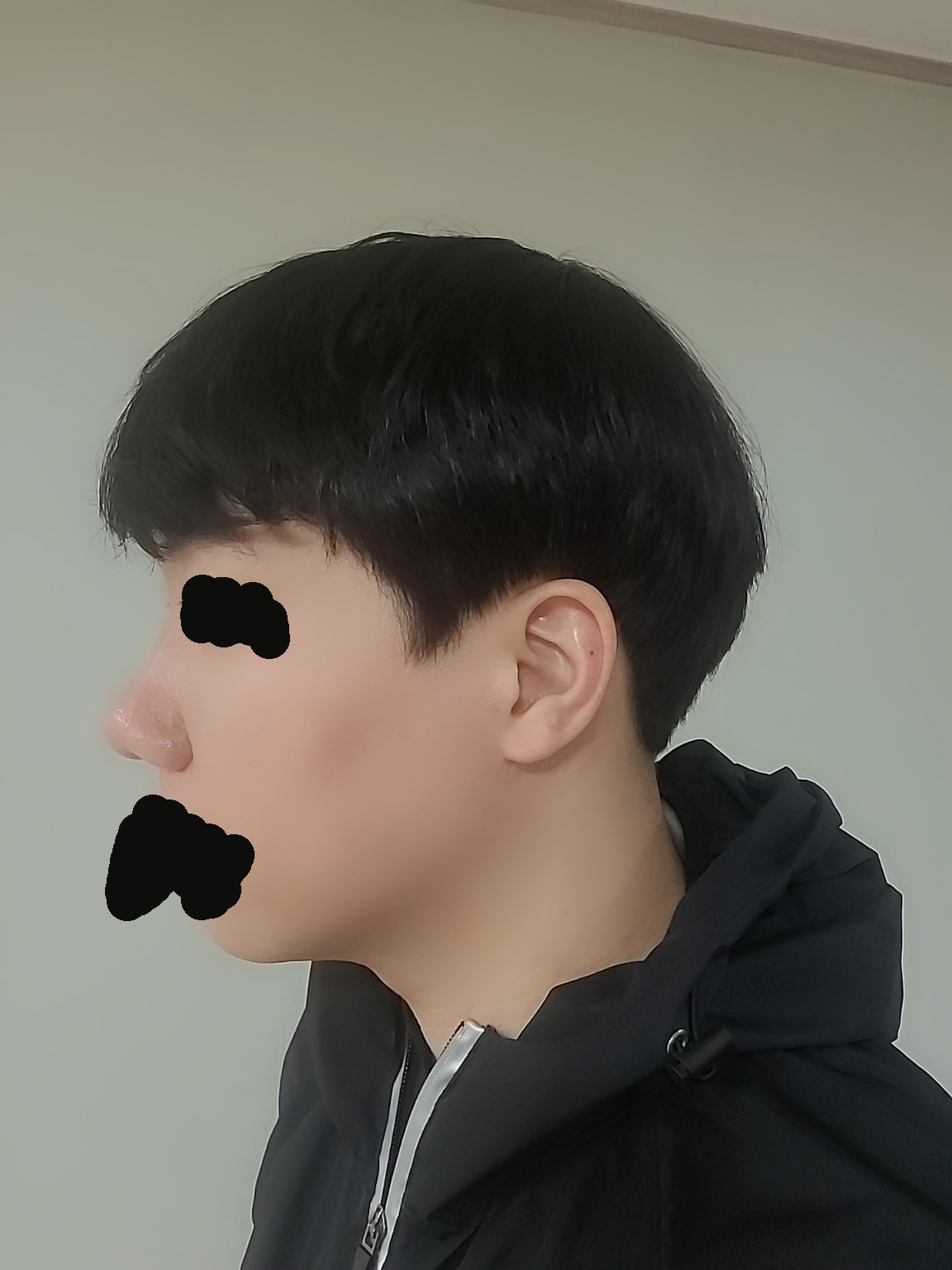 수술후기이미지