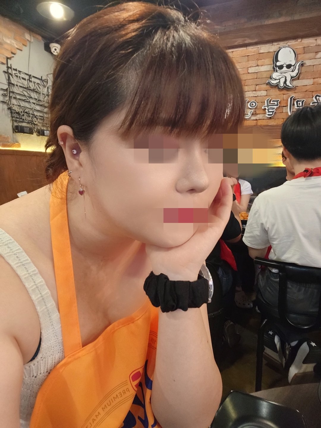 수술후기이미지