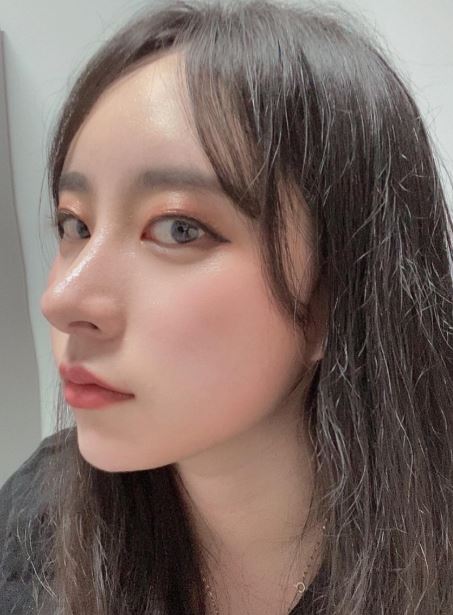 수술후기이미지