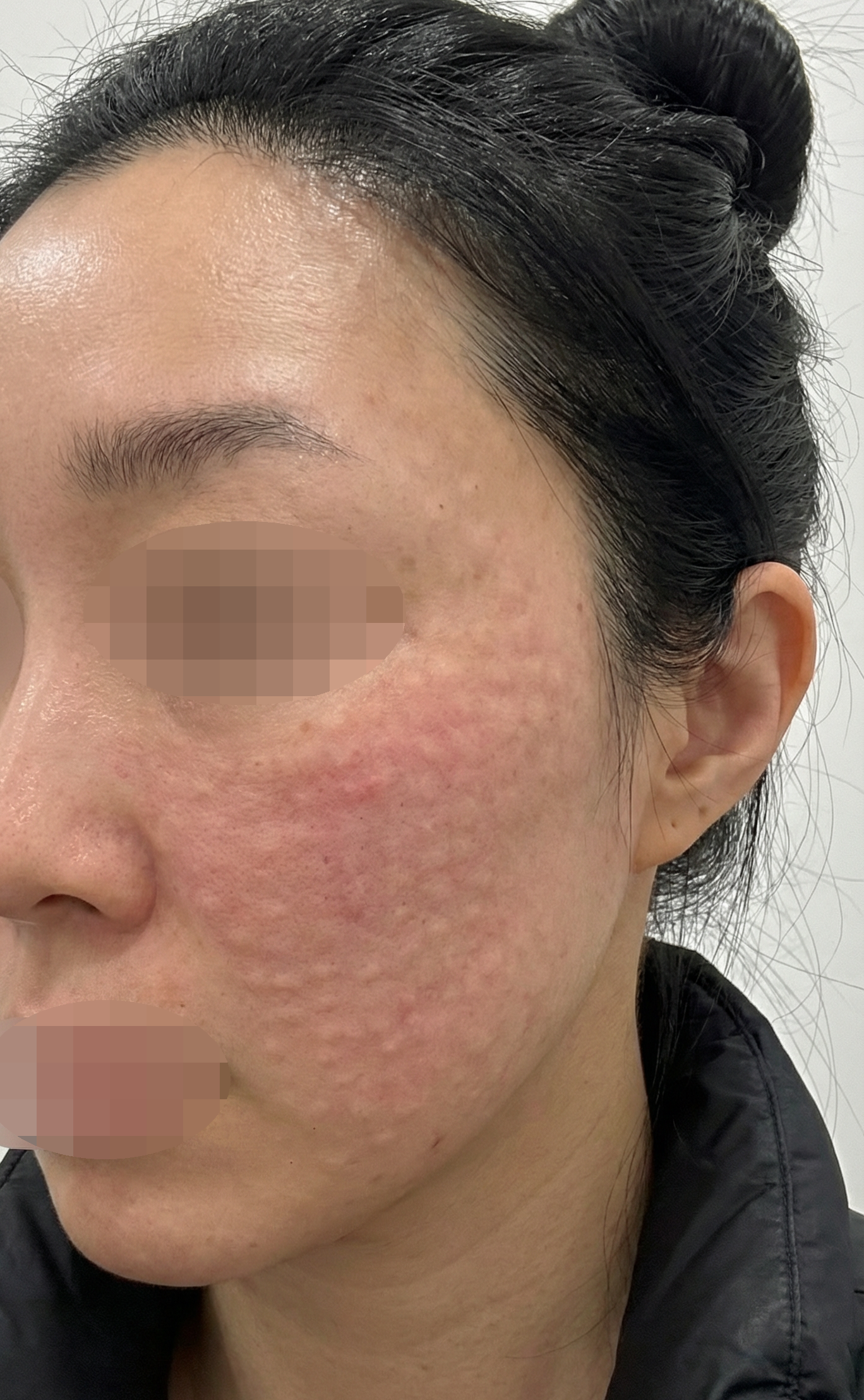 수술후기이미지