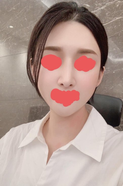 수술후기이미지