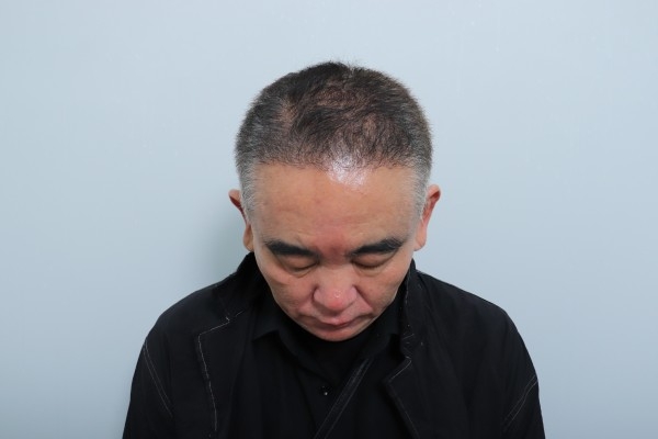 수술후기이미지