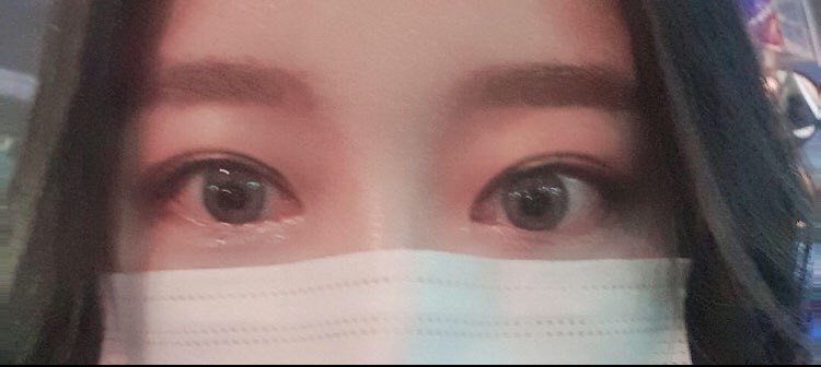 수술후기이미지