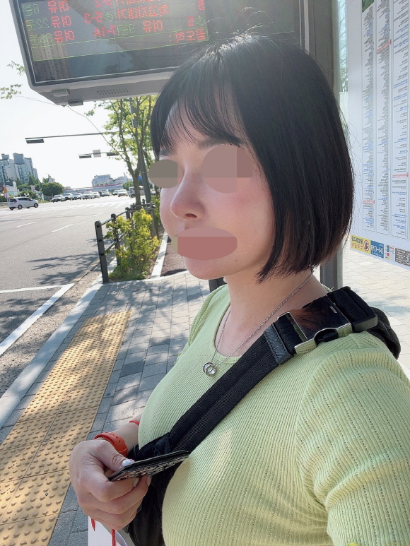 수술후기이미지