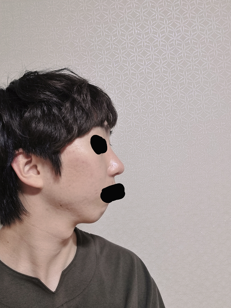 수술후기이미지