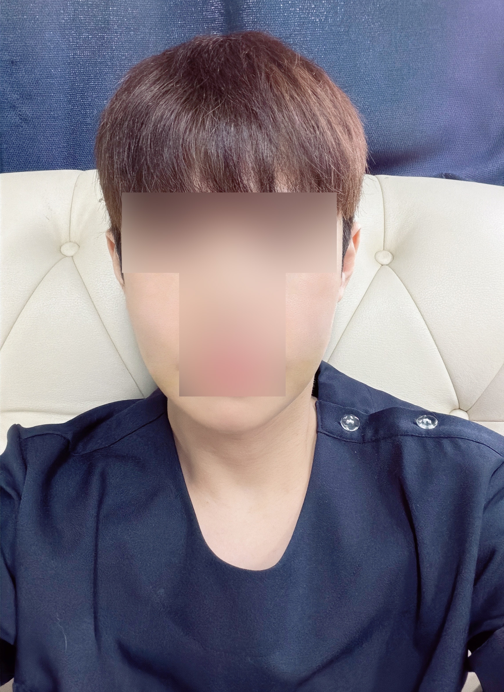수술후기이미지