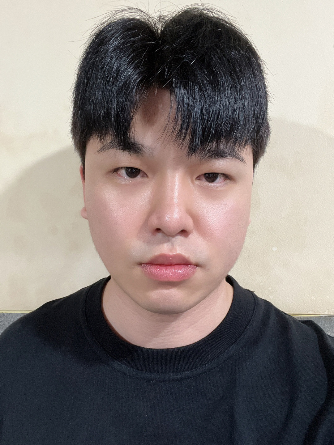 수술후기이미지