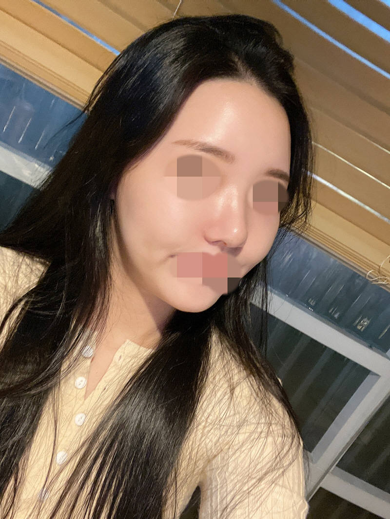 수술후기이미지