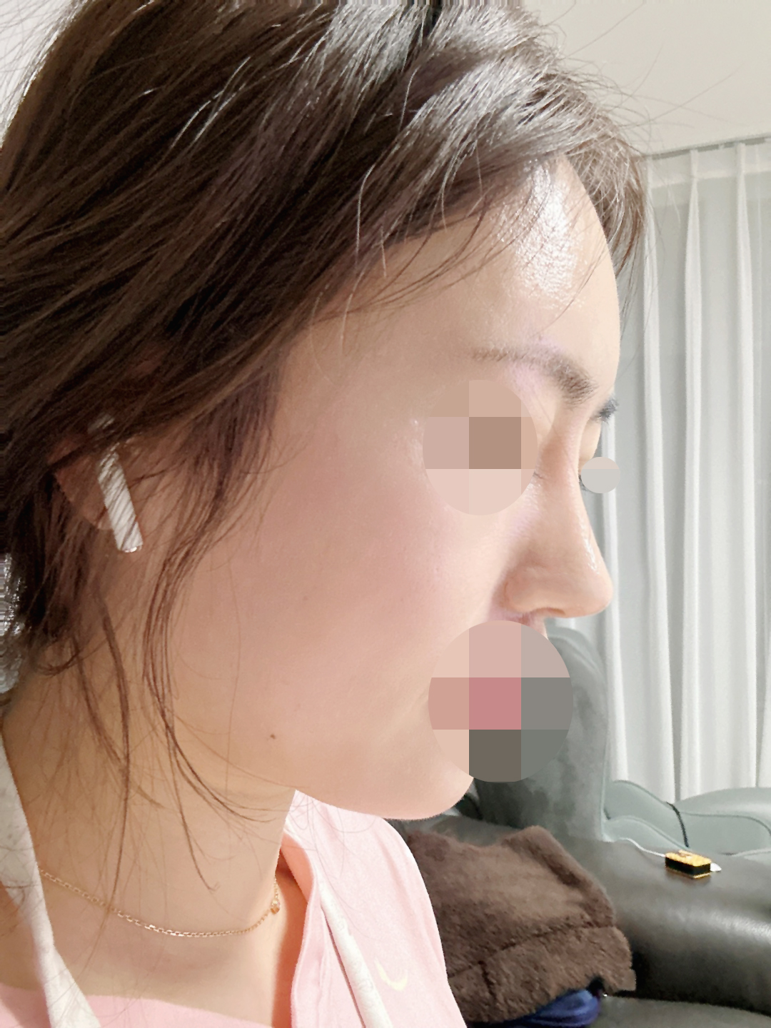 수술후기이미지