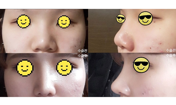 수술후기이미지