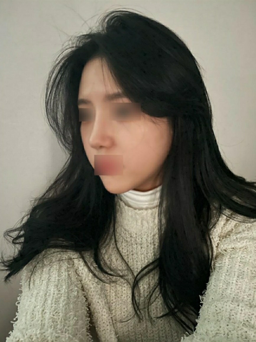 수술후기이미지